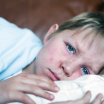 Measles rash and immunity information guide for prevention and protection during outbreak